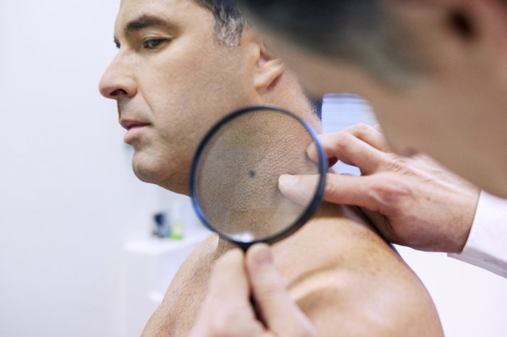 RSU Stomatoloģijas institūtā pieejami dermatologa pakalpojumi